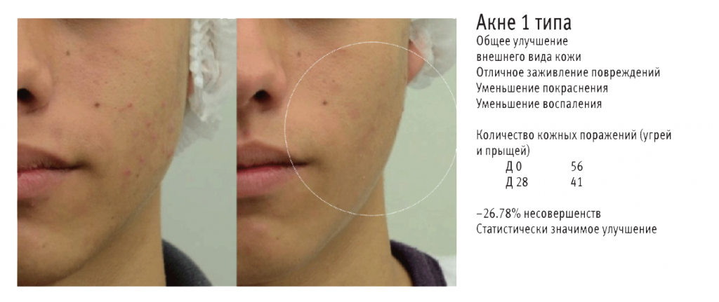 ProСlear-Морской-трипептид-С copy.png ProСlear-Морской-трипептид-С copy.png