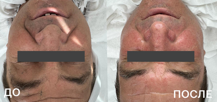 720х340_Гавриш_BioPhyto.jpg 720х340_Гавриш_BioPhyto.jpg