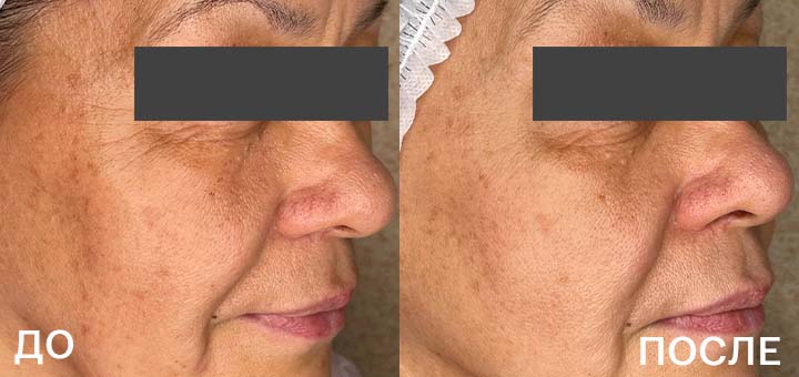 ДО_ПОСЛЕ_3.jpg