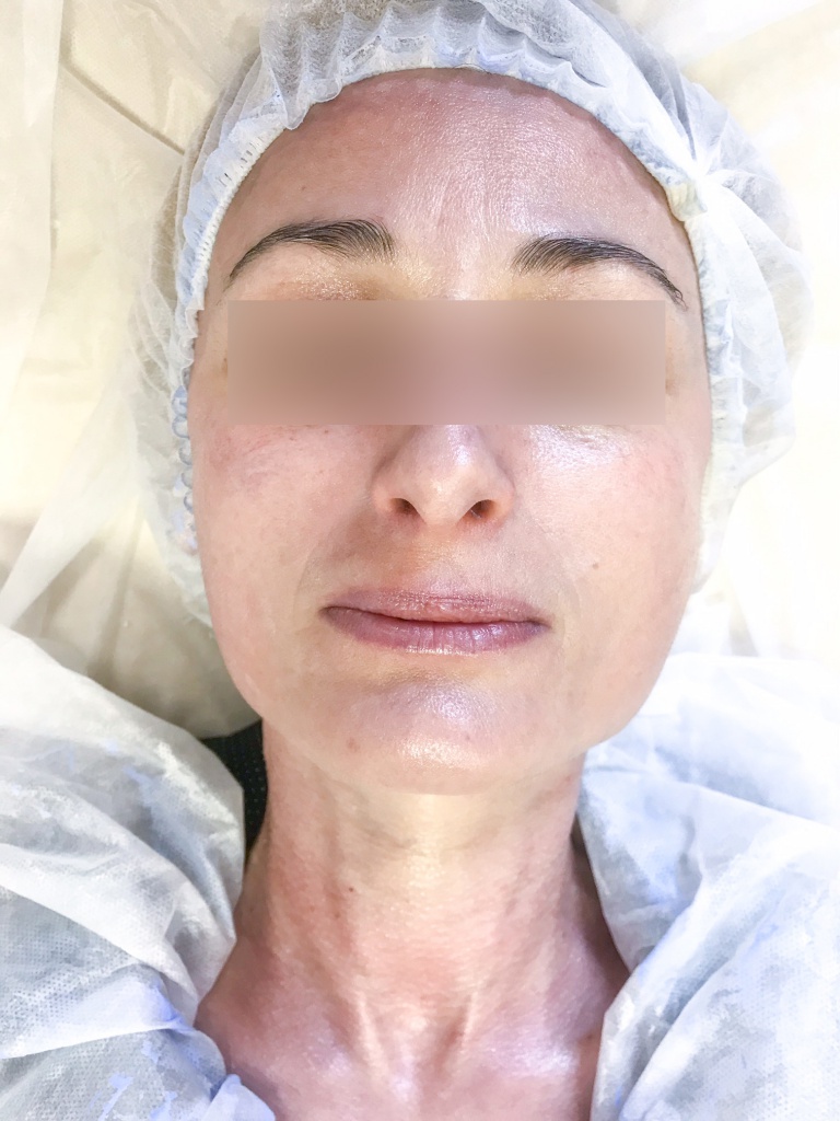 image1.jpeg image1.jpeg