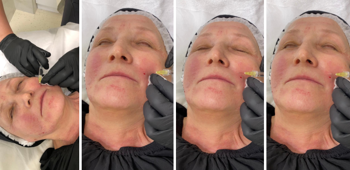 paporotnik.png paporotnik.png