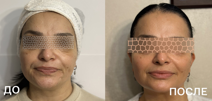 720х340_кейс_Бодокиа.jpg 720х340_кейс_Бодокиа.jpg