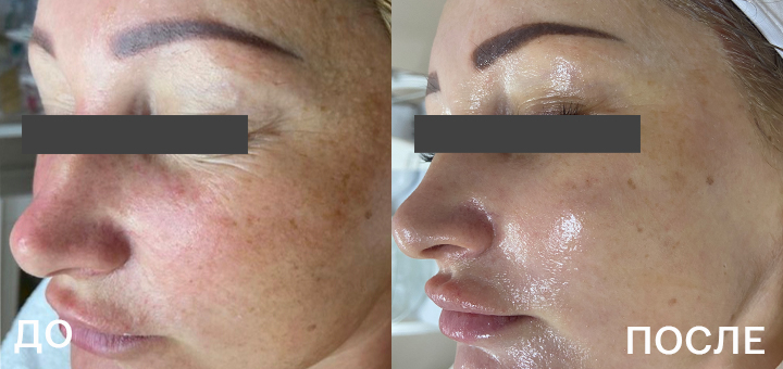 720х340_Гавриш_Silk.jpg 720х340_Гавриш_Silk.jpg