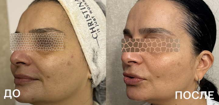 720х340_кейс_Бодокиа_2.jpg 720х340_кейс_Бодокиа_2.jpg