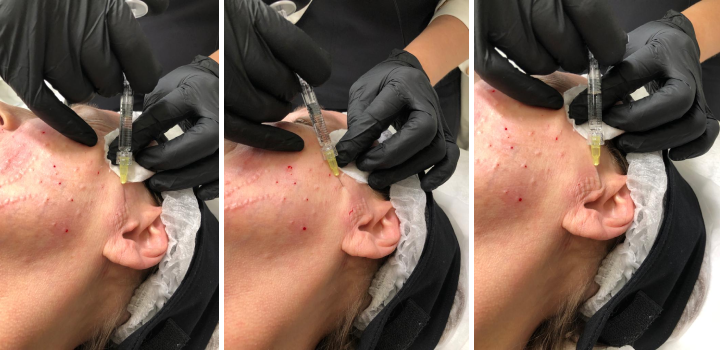 short-line.png short-line.png