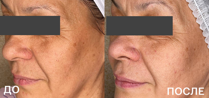ДО_ПОСЛЕ_4.jpg