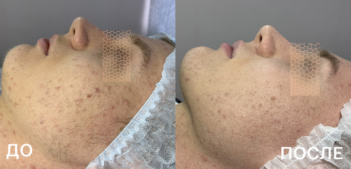 720х340_кейс_Гертан.jpg 720х340_кейс_Гертан.jpg