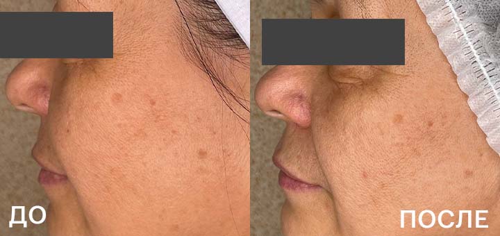 ДО_ПОСЛЕ_2.jpg